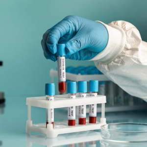 Blood Test